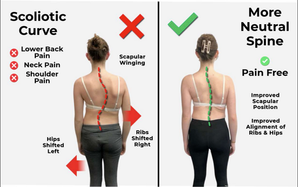Scoliosis & Asymmetry