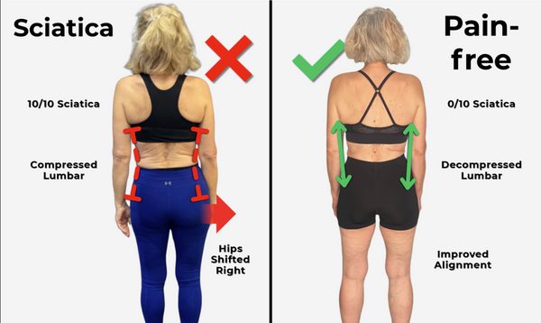 Sciatica & Nerve Relief