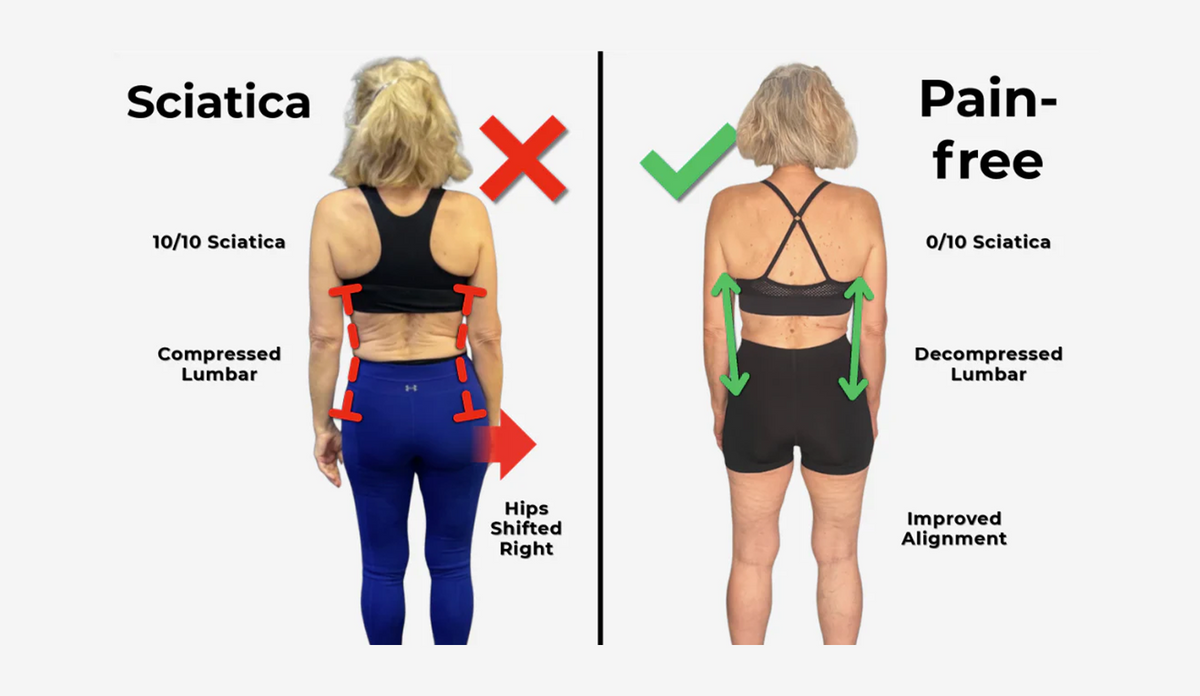 Sciatica & Nerve Relief