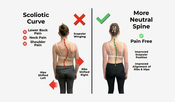 Scoliosis & Asymmetry