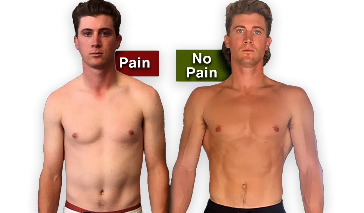 Before and after: client posture transformation from pain to no pain at Project Function
